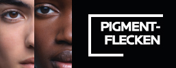 Pigmentflecken