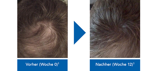 Fur Manner Apotal De Ihre Versandapotheke